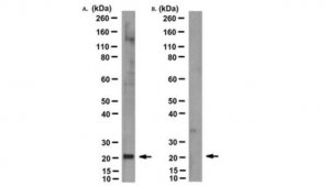 Anti-MT-ATP6 Antibody, clone 1G7-1G2 
