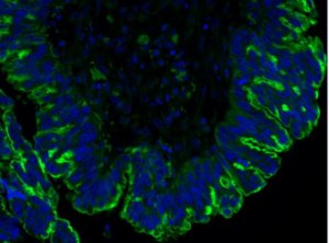 Anti-Mucin-16 (CA-125) Antibody, clone 5E11 MABC1608-25UG