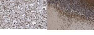 Anti-Myelin Basic Protein 