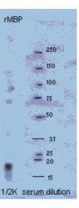 Anti-Myelin Basic protein Antibody 