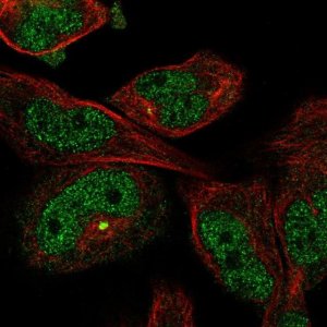 Anti-MYO18B antibody produced in rabbit 