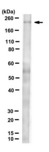 Anti-Myosin 7 (MYH7) Antibody, clone BA-D5 