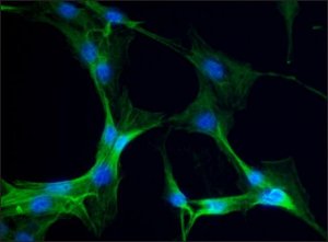 Anti-Myosin IIA, non muscle antibody produced in rabbit 