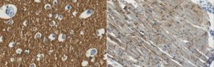 Anti-Na+/K+ ATPase alpha-3 