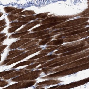 Anti-NBR1 antibody produced in rabbit 