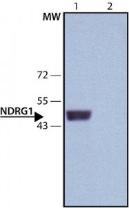 Anti-NDRG1 (C-terminal) antibody produced in rabbit 
