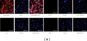 Anti-Nestin Antibody, clone 10C2 