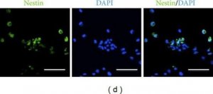 Anti-Nestin Antibody, clone 10C2 