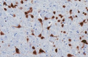 Anti-NeuN Antibody, clone 13E6, ZooMAb Rabbit Monoclonal 
