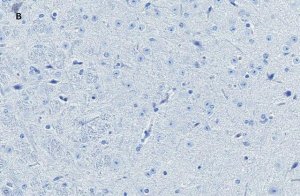 Anti-NeuN Antibody, clone 13E6, ZooMAb Rabbit Monoclonal 