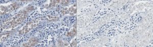 Anti-Neurofibromin C Antibody, clone NFC 