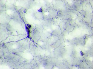Anti-Neuropeptide Y (NPY) antibody produced in rabbit 