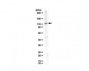 Anti-Neuropilin-2b 