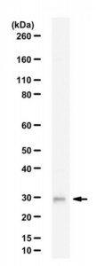 Anti-Nicotinamide N-methyltransferase 