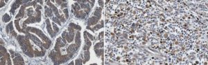 Anti-Nicotinic Acetylchone Receptor alpha 1 Antibody, clone 7C8.2 