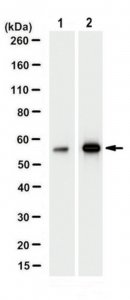 Anti-Nicotinic Acetylchone Receptor alpha 1 Antibody, clone 7C8.2 