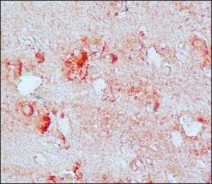 Anti-Nitrotyrosine antibody produced in rabbit 