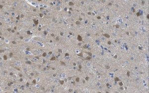 Anti-nonphospho-GSK3 (Ser9) Antibody, beta specific Antibody, clone 12B2 