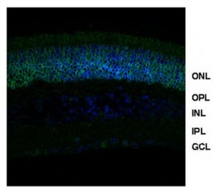 Anti-NRL (Neural Retina Leucine Zipper) 