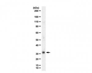 Anti-NRL (Neural Retina Leucine Zipper) 