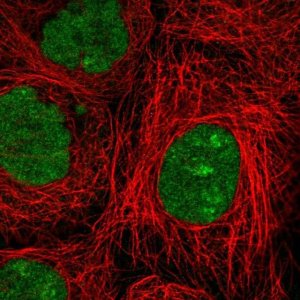 Anti-NSMCE2 antibody produced in rabbit 