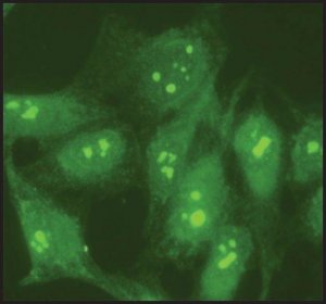 Anti-Nucleolin antibody produced in rabbit 