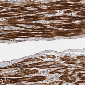 Anti-OSBPL9 antibody produced in rabbit 