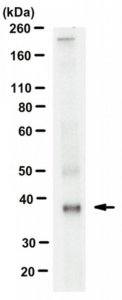 Anti-OSTM1 