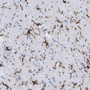 Anti-P2RY12 antibody produced in rabbit 