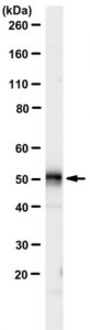 Anti-P2Y12 Receptor 