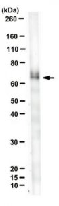 Anti-P40 (TP63) Antibody, clone 11H1 
