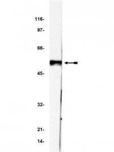 Anti-p53 Antibody, clone BP53-12 