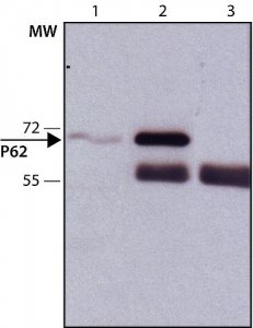 Anti-p62/SQSTM1 antibody produced in rabbit 