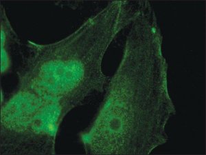 Anti-Palladin (C-terminal) antibody produced in rabbit 