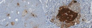 Anti-Pancreatic Polypeptide 