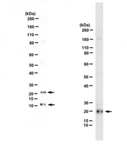 Anti-Pancreatic Polypeptide 