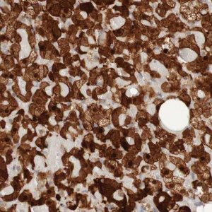 Anti-PARP4 antibody produced in rabbit 