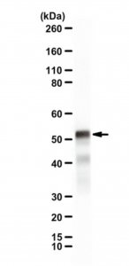 Anti-PAXIP1 
