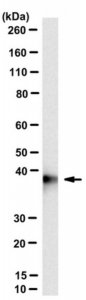Anti-PCBP2 (hnRNP E2) Antibody, clone PC81-1 