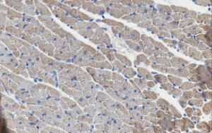 Anti-PD-L1 B7-H1 Antibody, clone 10B5 