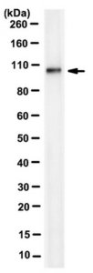 Anti-PDE6a Antibody, clone 7A11.1 