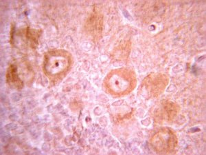Anti-PDGFR Antibody, clone CH-3 