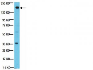Anti-PDGFR Antibody, clone CH-3 
