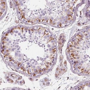 Anti-PGAP1 antibody produced in rabbit 