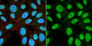 Anti-PHD finger protein 14 (PHF14) 