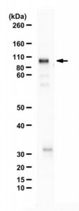Anti-PHD finger protein 14 (PHF14) 