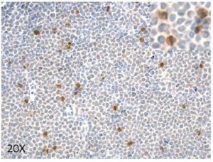 Anti-phospho 4E-BP1 (Ser83) ABE2889-25UL