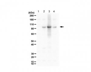 Anti-phospho RasGRP2 (Ser116/Ser117) 