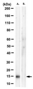 Anti-phospho-4E BP1 (Ser83) Antibody, clone CM14D3 