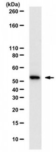 Anti-phospho-AKT1 Antibody, Thr479 